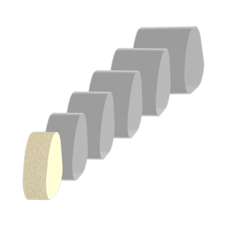 calc-cuboid arthrodesis