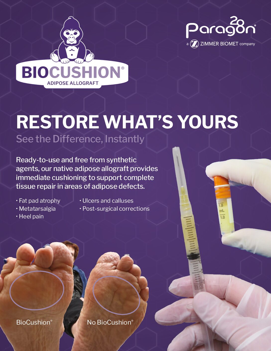 https://paragon.fru.qa/app/uploads/2020/01/C33436-BioCushion-Brochure-v02-pdf.jpg