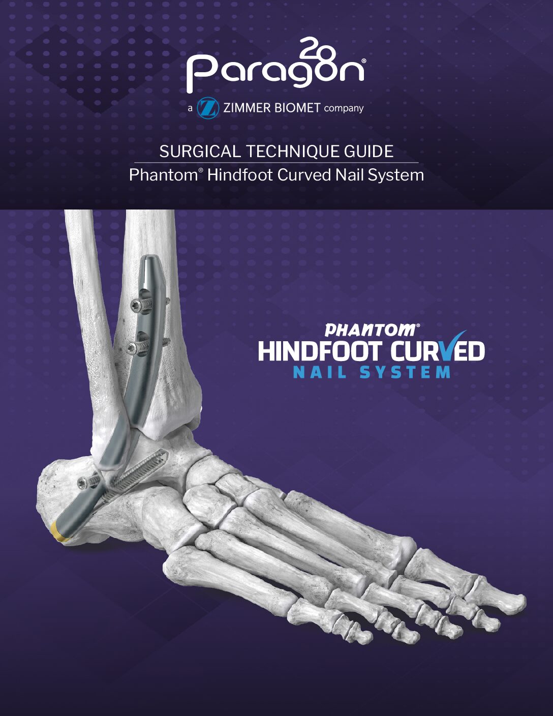 https://paragon.fru.qa/app/uploads/2020/01/P32-STG-0001-RevB_Phantom_Curved_Nail_STG-US-1-pdf.jpg