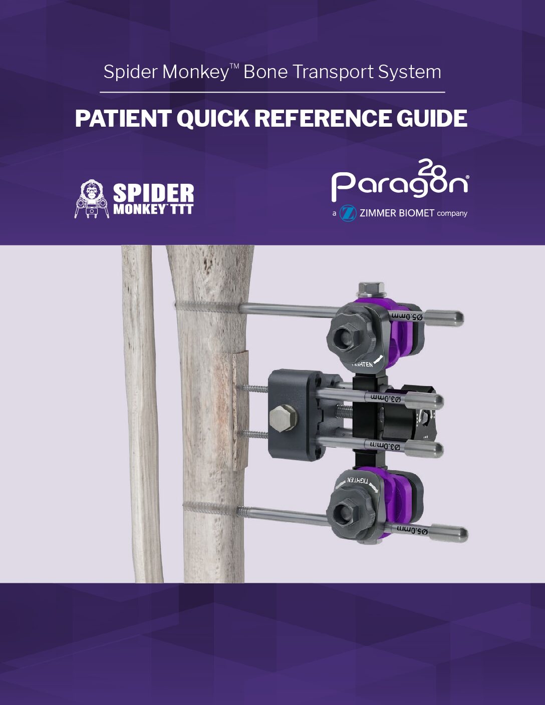 https://paragon.fru.qa/app/uploads/2020/01/P38-QRG-0001-RevA_Patient_Reference_Guide-pdf.jpg