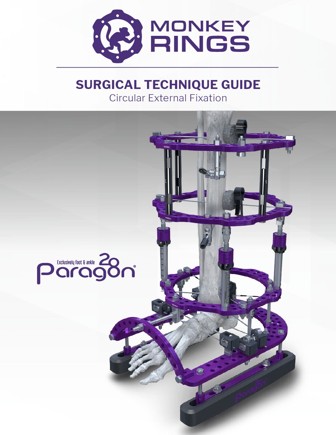 https://paragon.fru.qa/app/uploads/2020/01/P45-STG-0001-RevJ-Monkey-Rings-Circular-External-Fixation-System-pdf.jpg