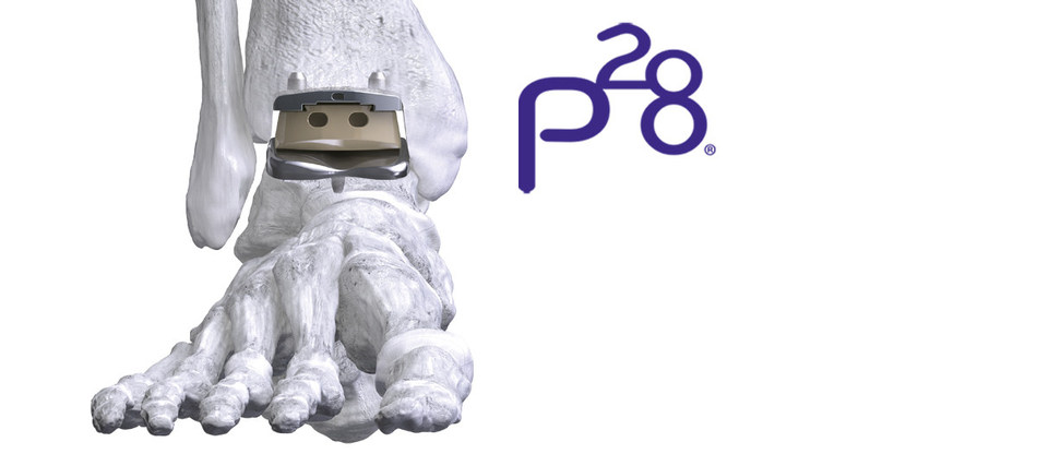 Paragon 28 APEX 3D APEX 3D™ Total Ankle Replacement System.