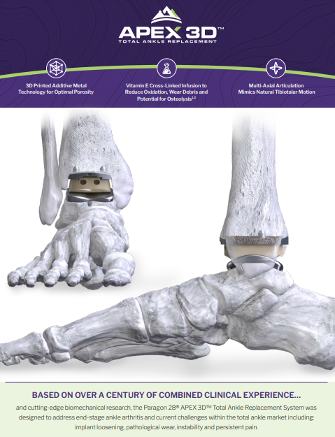 APEX 3D™ Total Ankle Replacement System