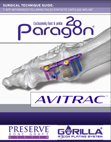 AVITRAC™ Surgical Technique Guide (US)