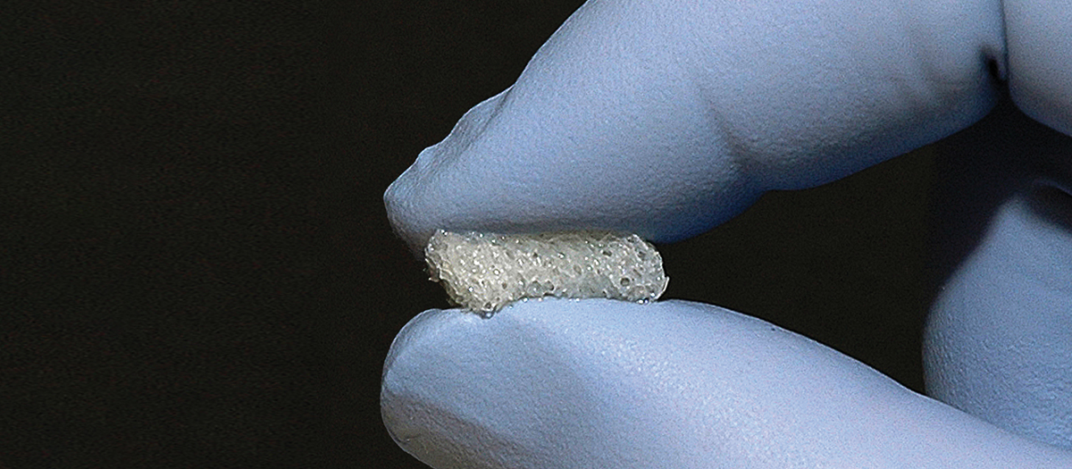 BEAST™ Osteobiologic Sponge (BOB™) BEAST™ Osteobiologic Sponge (BOB™)