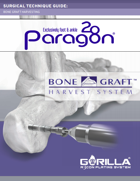 Bone Graft Harvest System Surgical Technique Guide (US)