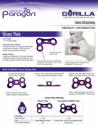 Evans Osteotomy Brochure