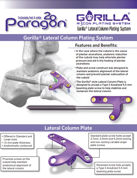 Gorilla® Lateral Column Plating System Brochure