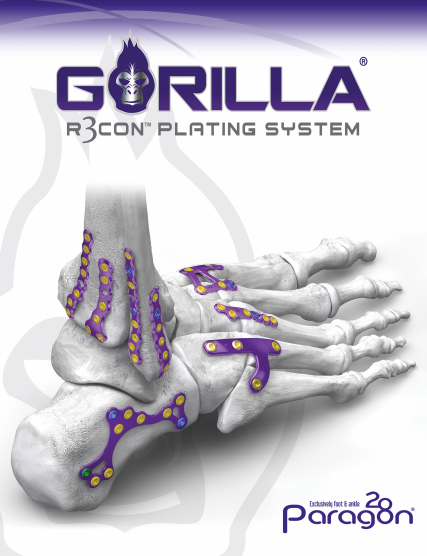 Gorilla® R3con Plating System Brochure