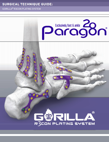Gorilla® R3con Plating System Surgical Technique Guide (CAN)