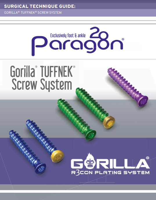 Gorilla® TUFFNEK® Screw System Surgical Technique Guide (US)