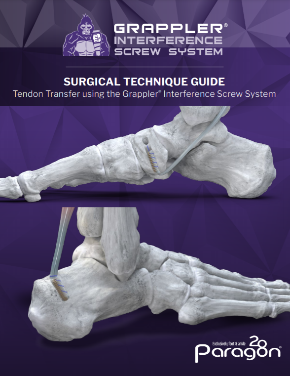 Grappler® Interference Screw System Surgical Technique Guide (CE Marked)