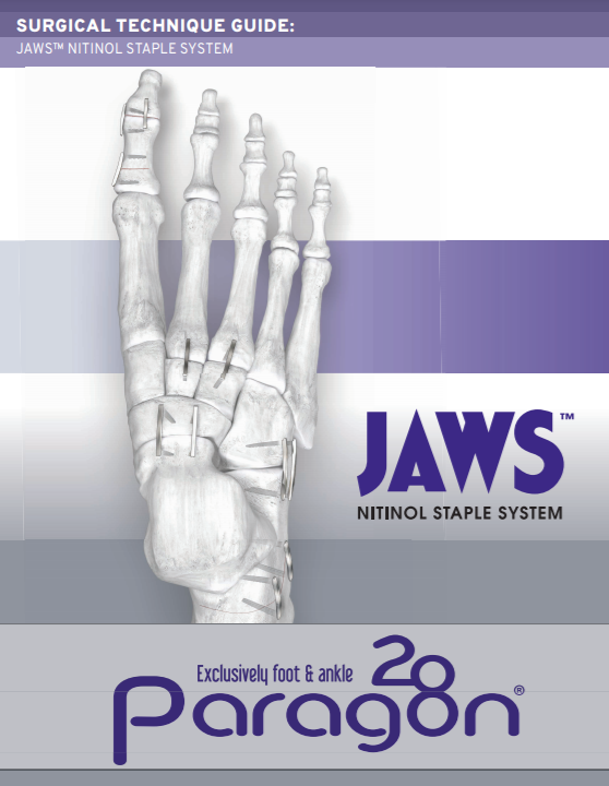 JAWS™ Nitinol Staple System Surgical Technique Guide (CE Marked)