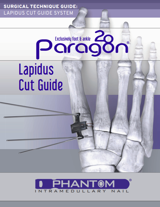 Lapidus Cut Guide System Surgical Technique Guide (US)