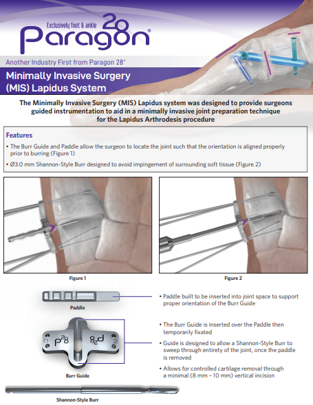 MIS Lapidus Brochure