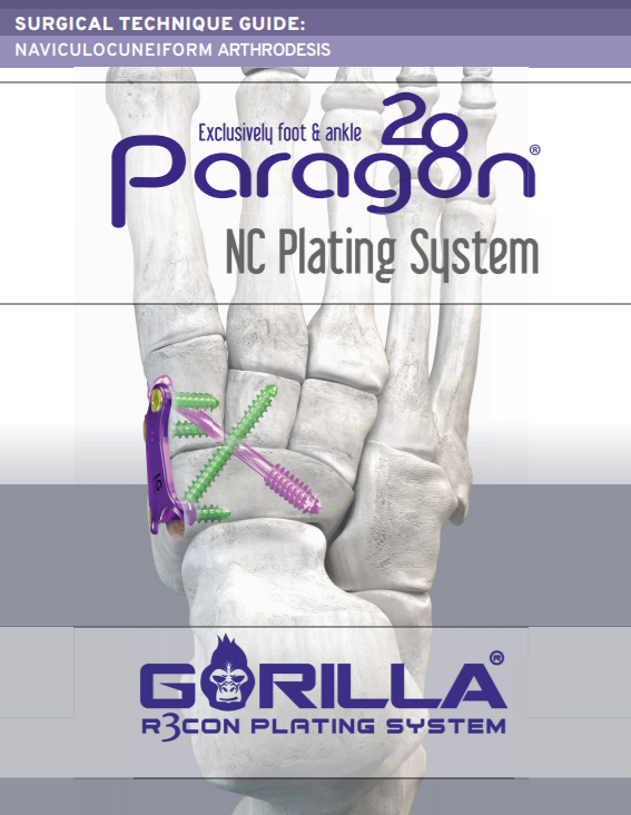 NC Fusion Plating System Surgical Technique Guide (CAN)