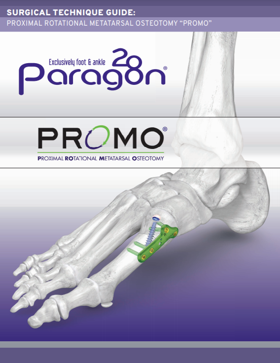 PROMO™ Triplanar Hallux Valgus Correction System Surgical Technique Guide (CAN)