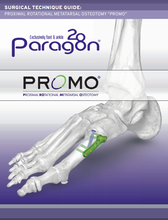 PROMO™ Triplanar Hallux Valgus Correction System Surgical Technique Guide (US)