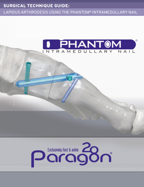 Phantom® Intramedullary Nail System Surgical Technique Guide (CE Marked)