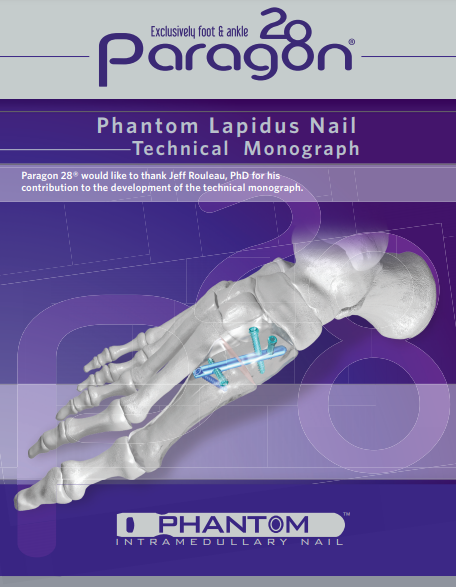 Phantom® Lapidus Nail Technical Monograph