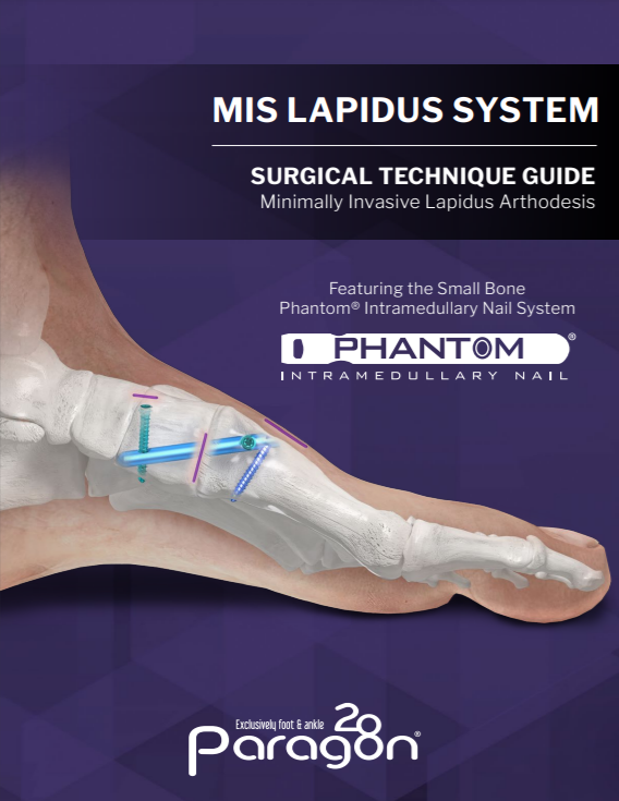 Phantom® MIS Lapidus Surgical Technique Guide (US)