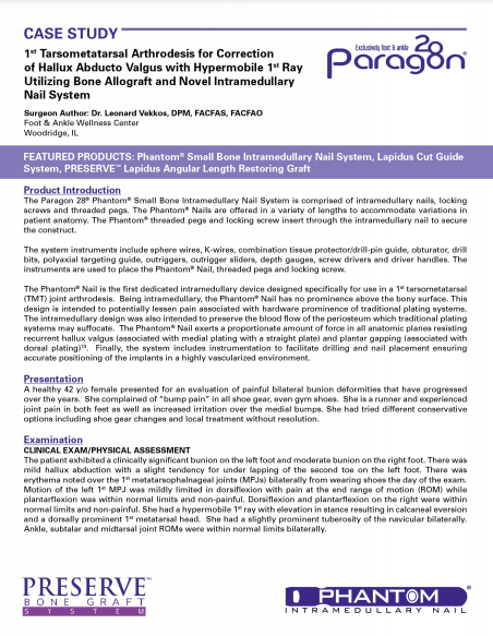 Phantom® Nail Case Study