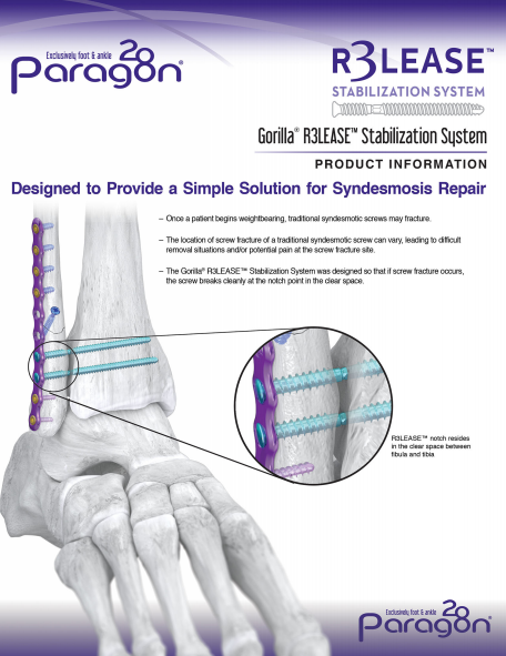 R3LEASE™ Stabilization Screw System Brochure
