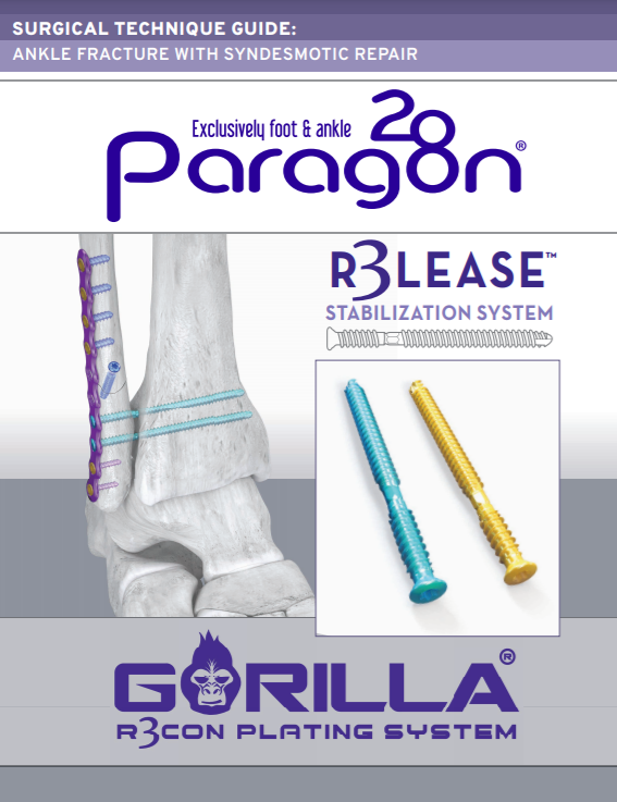 R3LEASE™ Stabilization System Surgical Technique Guide (US)