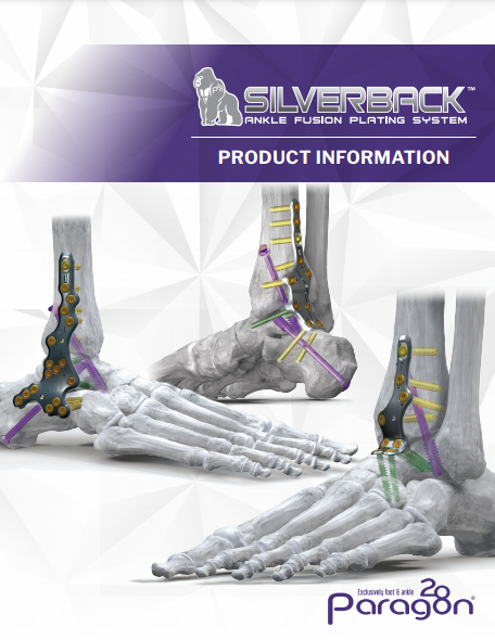 Silverback™ Ankle Fusion Plating System Brochure