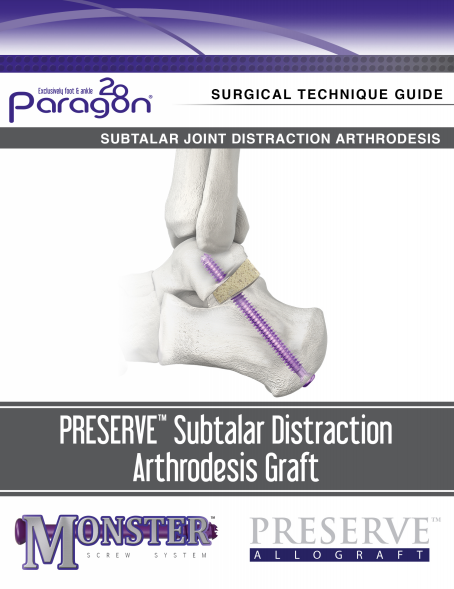 Subtalar Joint Distraction Arthrodesis Surgical Technique Guide (US)