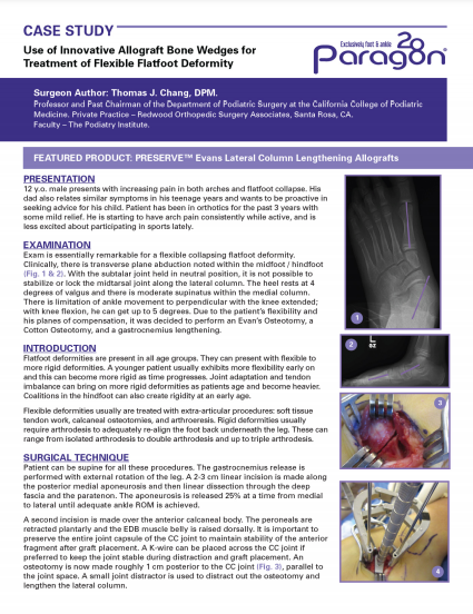Use of Innovative Allograft Bone Wedges for Treatment of Flexible Flatfoot Deformity