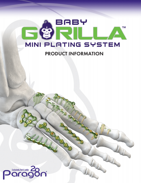 baby gorilla mini plating system brochure
