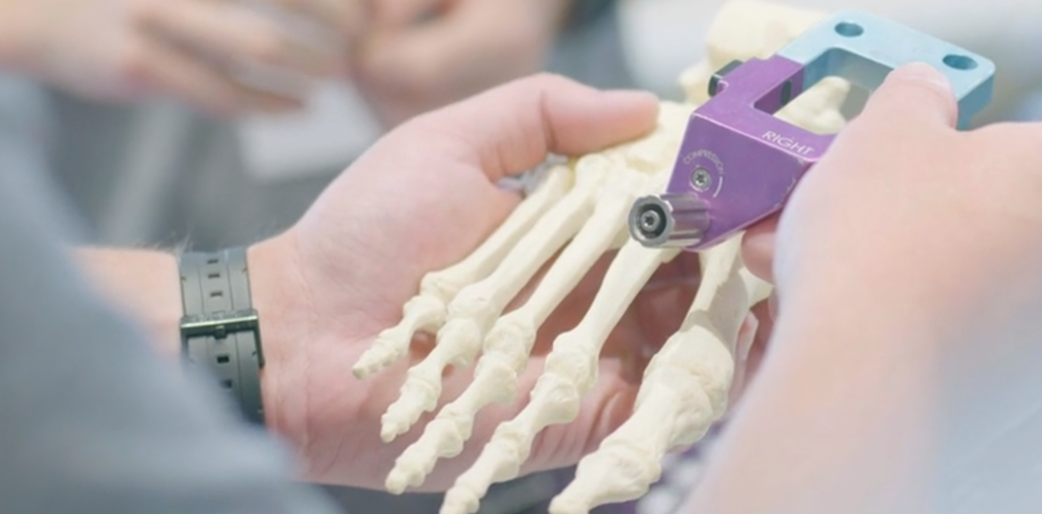 forward thinking paragon 28 forward thinking paragon 28