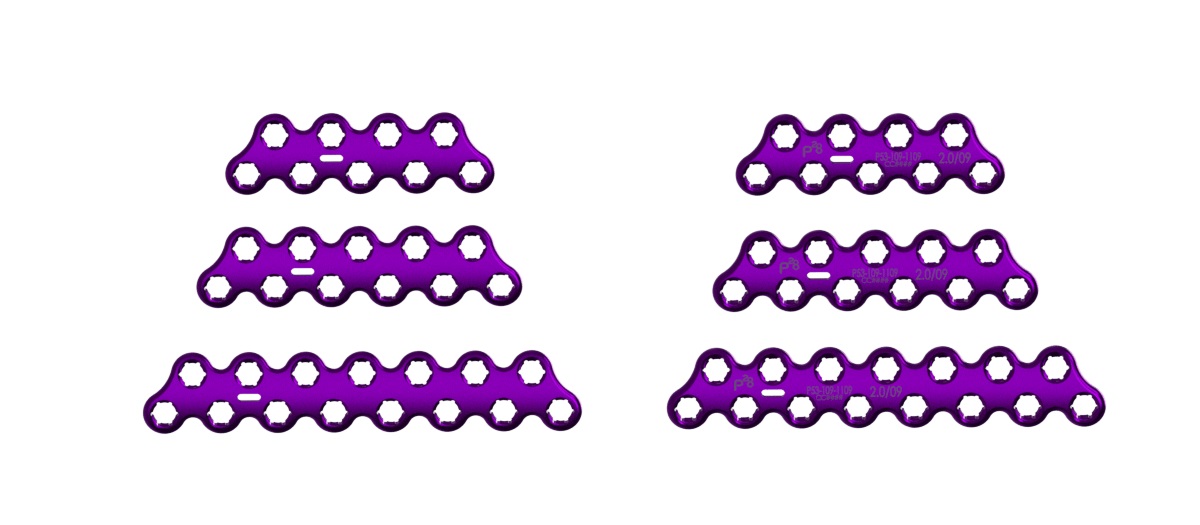 medial column rescue plates