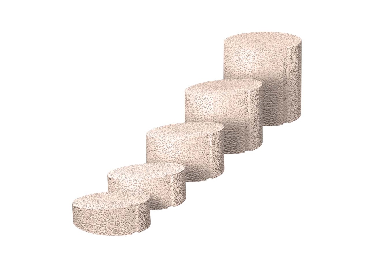 PRESERVE Subtalar Joint Distraction Arthrodesis Graft