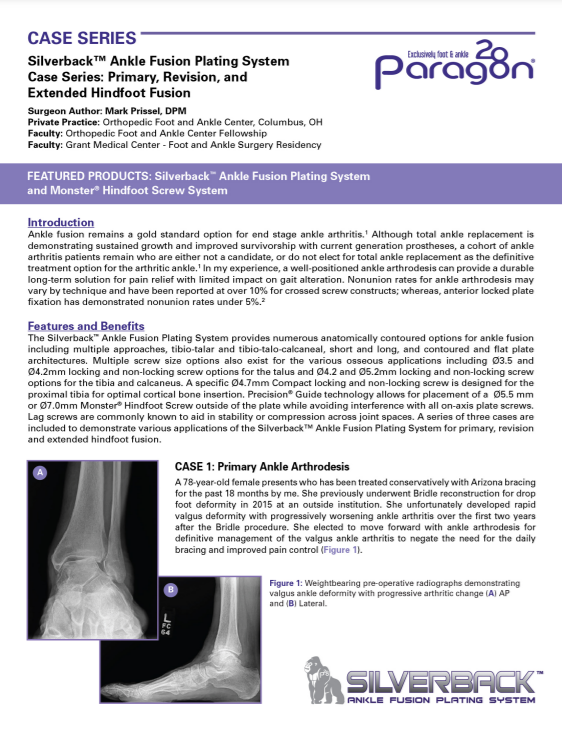 Silverback™ Ankle Fusion Plating System Case Series