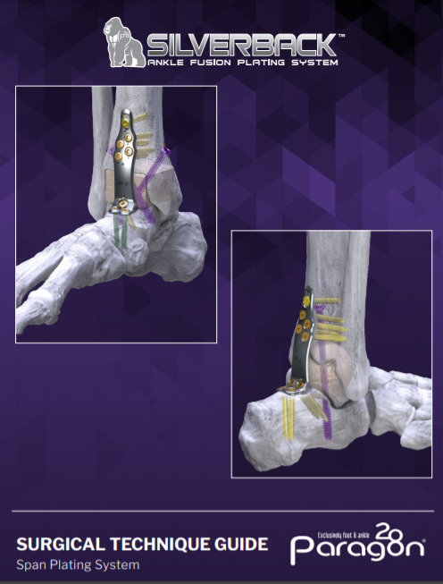 Silverback™ Span Plates Surgical Technique Guide