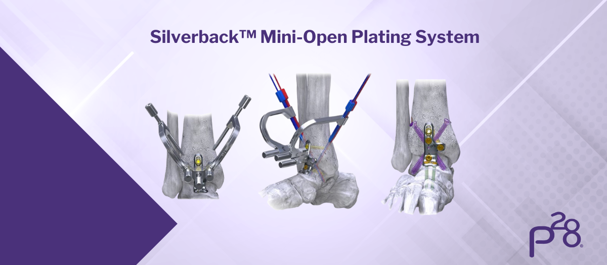 Mini-Open Blog Image (1200 x 525 px)