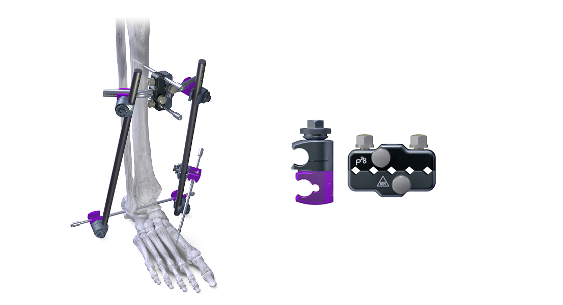 Monkey Bars Pinto Bar