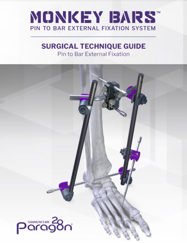 Monkey Bars Pin to Bar External Fixation System