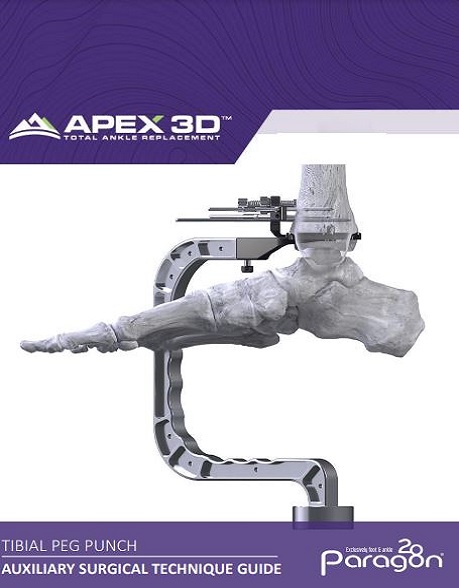 https://paragon.fru.qa/app/uploads/2022/01/APEX-3D™-Tibial-Peg-Punch-Auxiliary-Surgical-Technique-Guide-1.jpg