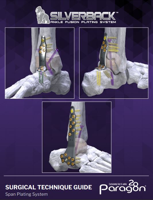 Silverback Span Plate