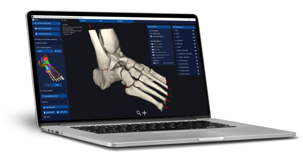 Laptopimage disior laptop image