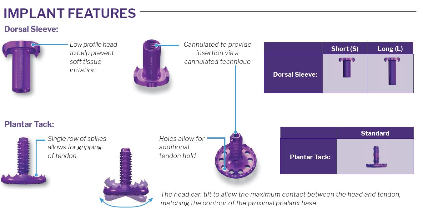 TenoTac Implant Features https://paragon.fru.qa/app/uploads/2022/05/TenoTac-Implant-Features.jpg