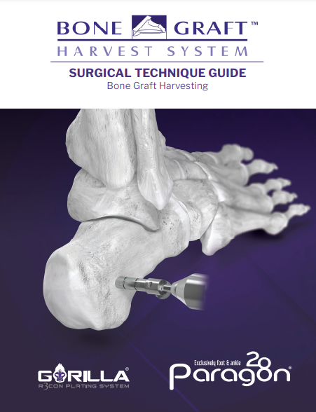 bone graft harvest ce