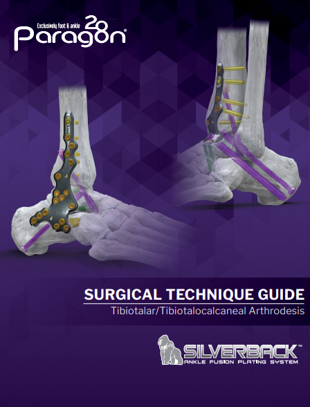 Silverback™ Ankle Fusion Plating System