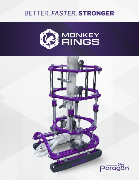 monkey rings