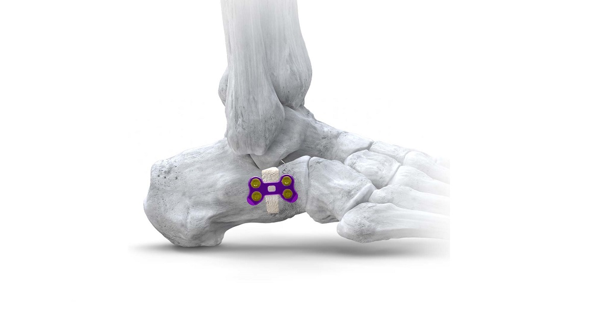 gorilla bow and arrow