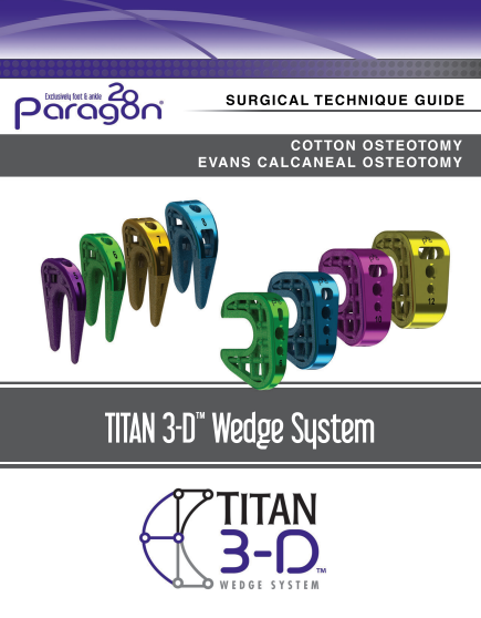 titan 3d wedge stg