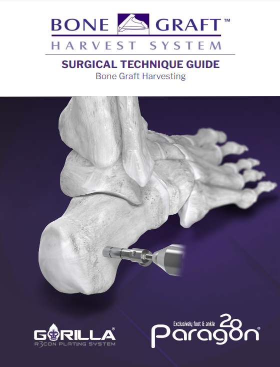 bone graft harvest system